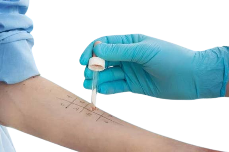 Allergy Testing