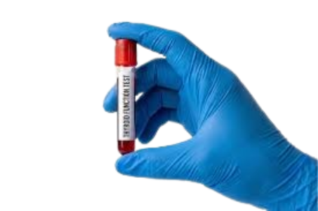 Thyroid Tests