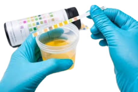 Urine Tests